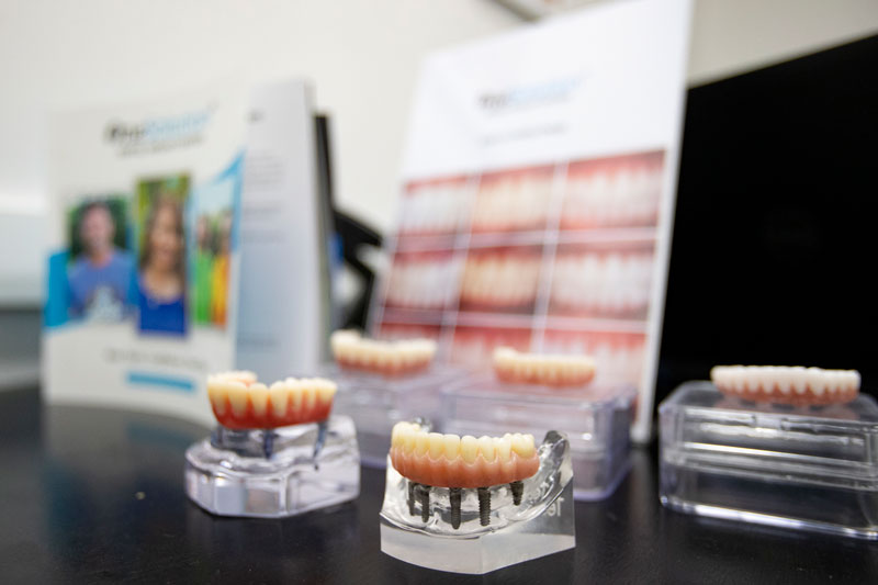 Full Arches Of Teeth at One Solution